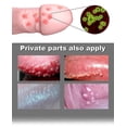 thumbnail image 2 of uds pomada para verrugas genitales crema para eliminar marcas en la piel rápido y amp; Eliminador eficaz de todo el pie, maíz, papiloma, verrugas, lunares, hierbas, crema A635 kaili Sencillez, 2 of 5