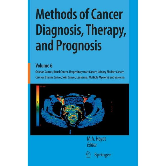 Methods of Cancer Diagnosis, Therapy and Methods of Cancer Diagnosis, Therapy, and Prognosis: Ovarian Cancer, Renal Cancer, Urogenitary Tract Cancer, Urinary Bla, Book 6, (Hardcover)
