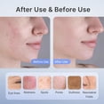 thumbnail image 6 of Dr.pedi 280 LED Red Light Therapy Face Mask for Facial Skin Care, 4 Modes Infrared Light Therapy Mask with Eye Protection, Rechargeable 3000mAh Battery, Home Use Anti-Aging Skincare Device, 6 of 8