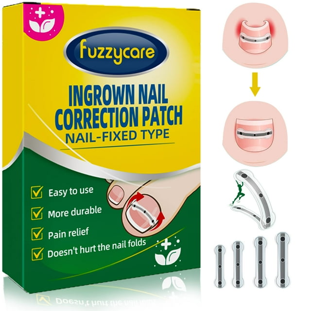 Kit de tratamiento y eliminación de uñas encarnadas Fuzzycare Titanium