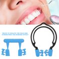 thumbnail image 4 of Matrices Contorneadas Dentales, Matrices Dentales, De Uso Confiable Fácil Y Conveniente No Es Fácil Romper Los Dientes Para El Hospital ANGGREK Tipo B, 4 of 8