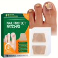thumbnail image 2 of Nail Care Post, About Subungual Hematoma, Yellow Nail Syndrome, Fungal, 2 of 6