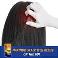 thumbnail image 2 of scalp itch relief, 1.5 fl oz. strength (pack of 2), 2 of 2