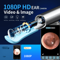 thumbnail image 3 of KEKOY Ear Camera and Wax Remover, 1080P Ear Wax Removal Kit, Wireless Otoscope Ear Cleaning Kit with Lights and 6 Ear Scoops, 3 of 9
