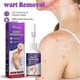 thumbnail image 3 of Corn And Calluses Remover Gel Foot Callus Removal Treatment Hard Skin Pedicure, 3 of 5