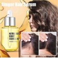 thumbnail image 2 of Sérum de jengibre para el crecimiento del cabello fino, aceite nutritivo botánico natural para el cuero cabelludo 35 ml (3 unidades), 2 of 5