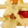 thumbnail image 4 of Modelo Lumbar Humano 1:1.5 Hernia De Disco Anatómica De La Columna Vertebral, 4 of 7