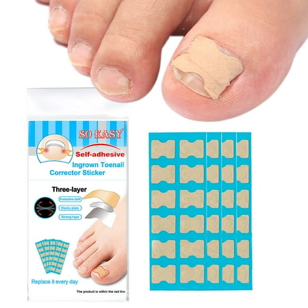 toenail stick stickers patch correction pedicure adhesive ingrown corrector elastic glue toe bars nail sticker foot non care