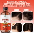 thumbnail image 4 of Organic Raw Batana Oil 100ML Premium Hair Growth Oil for Thicker, Stronger Hair - 100% Pure & Natural - Rich in Vitamin E & Omega-3 Dr. Sebi (Honduran Herbalist), 4 of 5