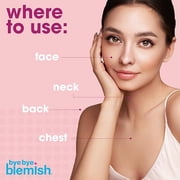 Bye Bye Blemish Acne Drying Lotion with Salicylic Acid for Pimple Care, 1 fl oz