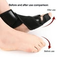 thumbnail image 2 of AFO Foot Drop Brace Ankle Foot Orthosis for Left/Right Foot Adjustable Foot Support Stabilizer for Plantar Fasciitis, 2 of 8