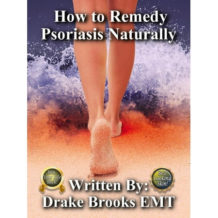 How to Remedy Psoriasis Naturally - eBook (Best Way To Treat Psoriasis Naturally)