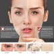 thumbnail image 3 of 1 bolígrafo eliminador de nevus de plasma láser, eliminador de verrugas y pecas para tatuajes, cuidado de la piel facial, eliminador de espinillas y manchas Rojo Verde, 3 of 5