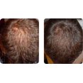 thumbnail image 3 of Revivogen PRO Thickening Conditioner,8 Fl Oz, 3 of 3