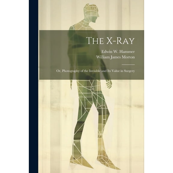 The X-Ray; Or, Photography of the Invisible and Its Value in Surgery (Paperback)