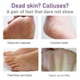 thumbnail image 4 of Upgraded 2026 Foot Mask Exfoliating Dead Exfoliating Calluses And Heel Cuticles Foot Mask Care 6ml, 4 of 7