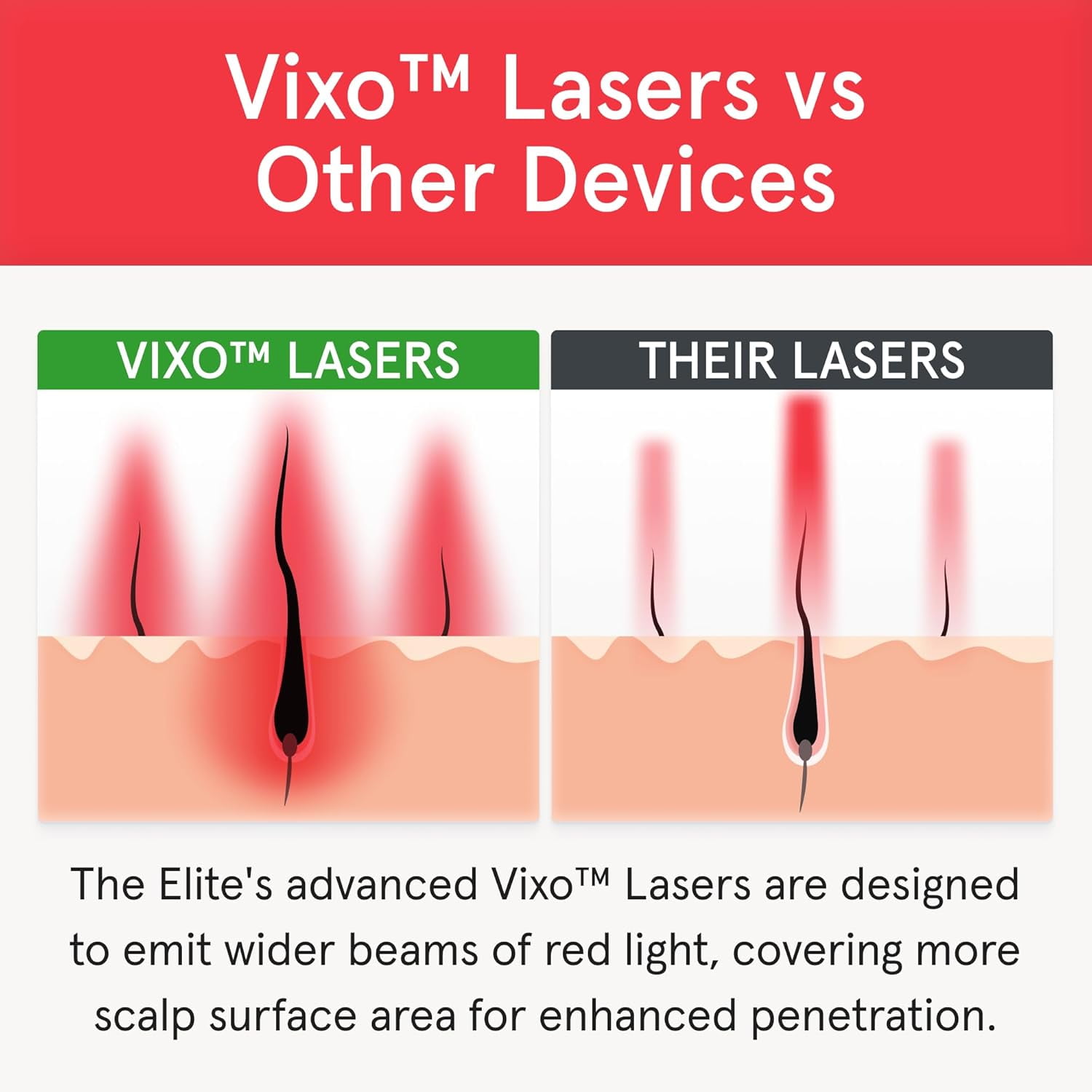 iRestore Elite - Laser Red Light Therapy for Hair Growth System - FDA Cleared