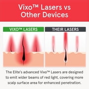 iRestore Elite - Laser Red Light Therapy for Hair Growth System - FDA Cleared