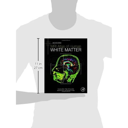 Pre-Owned MRI Atlas of Human White Matter [Hardcover] Oishi, Kenichi; Faria, Andreia V.; van Zijl, Peter C M and Mori, Susumu