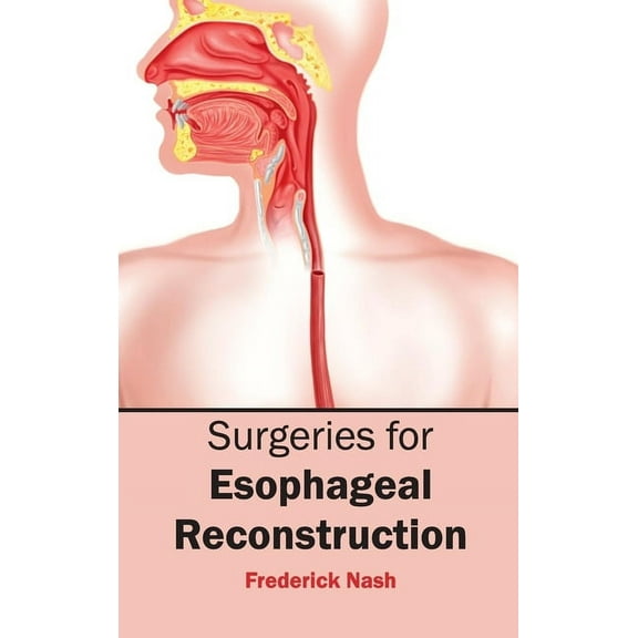 Surgeries for Esophageal Reconstruction, (Hardcover)