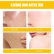 thumbnail image 1 of Crema de eliminación de acné quístico de 30 ml reparación hidratante antiacné blanqueamiento de la piel Sywqhk Cuidado Belleza, 1 of 6
