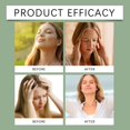 thumbnail image 3 of Anti-Dizzy Roll-On, Natural Ingredients for Vertigo Relief, Portable Roller for Travel & Daily Use, Fast-Acting, 3 of 8