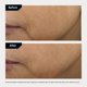 thumbnail image 5 of Crema facial Moisturizer Revision Skincare D·E·J® 15 ml, 5 of 6