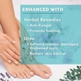 thumbnail image 4 of Ebanel Athletes Foot Fungus Treatment Extra Strength with Miconazole, Undecylenic Acid, Tea Tree Oil, Herbal Remedies, Antifungal Cream for Skin to Kill Fungi Lead to Nail Fungus, Ringworm, Jock Itch, 4 of 5