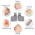 thumbnail image 2 of Graflsoa Bunion Relief Foot Sleeves - Adjustable Toe Alignment Support for Men & Women, Grey, Medium Size, Pair Included, 2 of 6