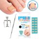 thumbnail image 1 of Ingrown Nail Correction Kit Ingrown Toenail Stickers Toe Nail Clamp & Lifter Straightening Treatment Recover Corrector Toe Nail Fingernail Care Tool, 1 of 5