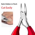 thumbnail image 2 of Toe Nail Clippers Nail Correction Thick Nails Ingrown Toenails Nippers Cutters Dead Skin Dirt Remover Pedicure Care Tool heqiyong LED, 2 of 2