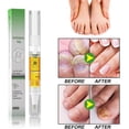 thumbnail image 4 of Lápiz reparr de uñas, lápiz extrafuerte para uñas de los pies: solución para uñas dañadas con aplicr de pincel, fórmula transparente de sec rápido, 4 of 4