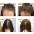 thumbnail image 4 of Fiudx Suero Reparador Capilar, Tratamiento Intensivo de Recuperación de Daños, Mezcla Nutritiva de Argán y Rosa, Control Del Frizz y Prevención de Puntas Abiertas, Masaje Diario Del Cuero Cabelludo,, 4 of 6