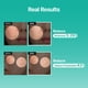 thumbnail image 3 of Suero Meditherapy PDRN Skin Booster Centella y D-Pantenol 100 mL, 3 of 9