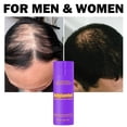 thumbnail image 4 of Adglamful Hair Building Fibers for Thinning Hair, Natural-Looking Hair Appearance Enhancer, Easy to Apply, Black, 30g / 1.05oz, 4 of 7