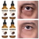 thumbnail image 4 of Aceite esencial de suero para ojos con , 30 ml, 1 para reducir las arrugas y las líneas finas 4 piezas shamjiam suero de ojos, 4 of 7
