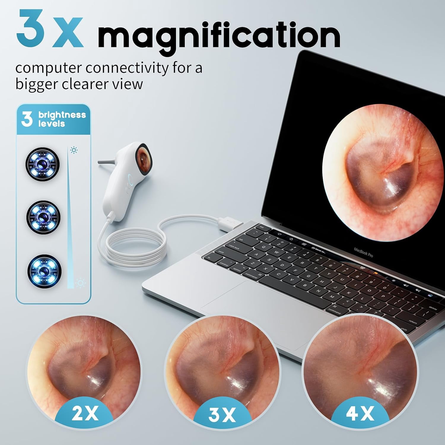 Smart Otoscope Ear Camera with 1.38'' Screen, 1080P Ear Scope with 4 LEDs, 12 Silicone Specula Tips, Support Photo and Video, PC View, Ideal Pocket Otoscope for Adults, Kids and Pets
