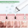 thumbnail image 5 of Aspiradora de puntos negros, limpiador de poros faciales visible WIFI mejorado con cámara de botón con 6 cabezales de succión herramienta de succión eléctrica recargable, 5 of 5