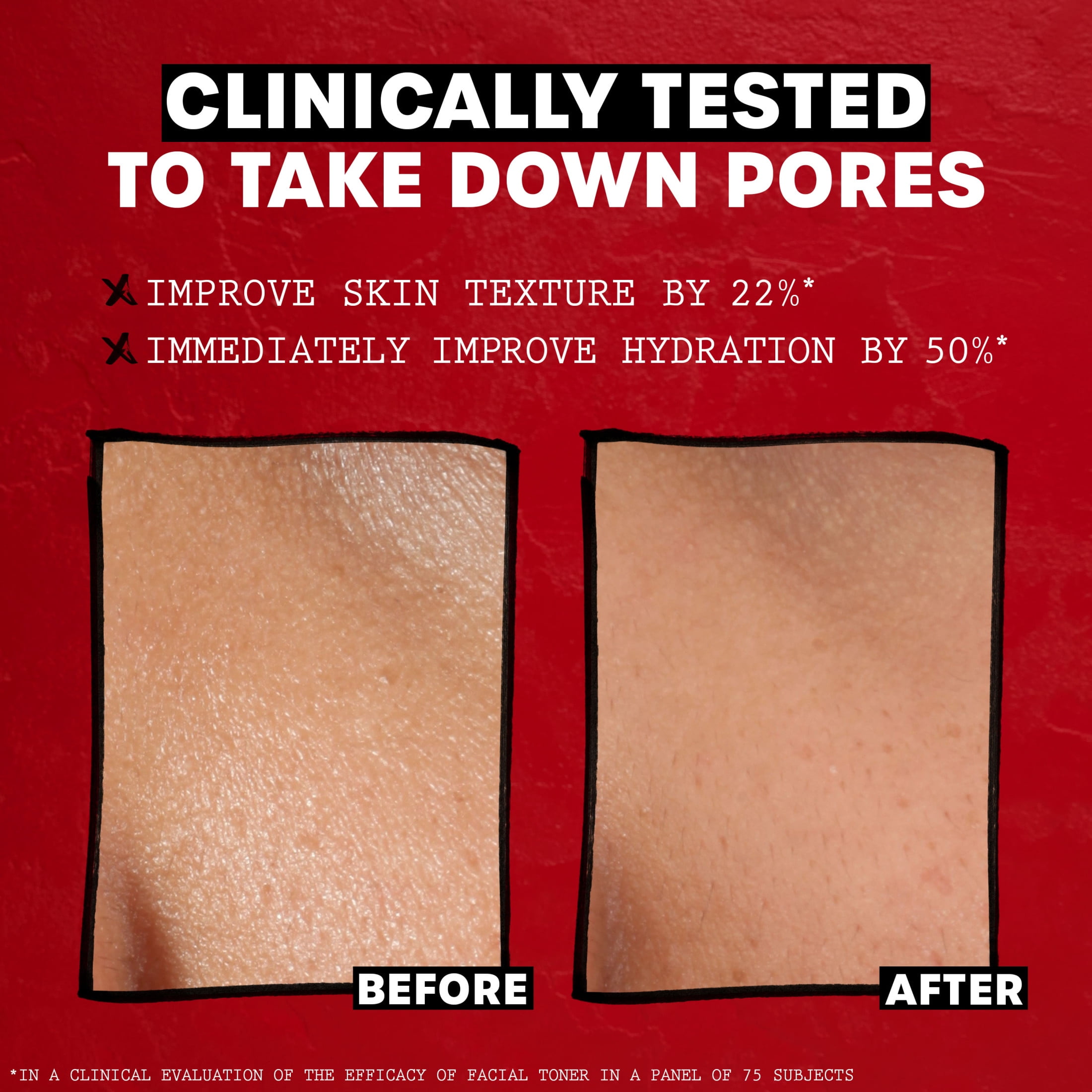 Thayers Alcohol-Free Unscented Witch Hazel Facial Toner for Dry Skin 8.5 fl oz