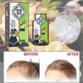 thumbnail image 2 of Ginger Plant Extract Anti-hair Loss Hair Shampoo, 2024 New Ginger Plant Extract Anti-hair Loss Hair Shampoo, Ginger Shampoo For Hair Growth, 2 of 5