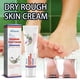 thumbnail image 4 of Cremas y lociones para pies Crema antigrietas Manos y pies secos y agrietados Crema para pies agrietados Crema reparadora de manos Crema hidratante para piel muerta del talón Crema hidratante de 60 ml, 4 of 5