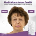 thumbnail image 3 of Sérum para ojos Beverly Hills Instant Facelift Antienvejecimiento 30 ml, 3 of 8