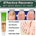 thumbnail image 2 of Crema Para Eliminar Hongos En Las Uñas, Para Grietas, Rugosidad, Decoloración, Fragilidad, Eliminación De Hongos En Las Uñas De Los Pies, Ungüento Para El Cuidado De Las Uñas, 2 of 8
