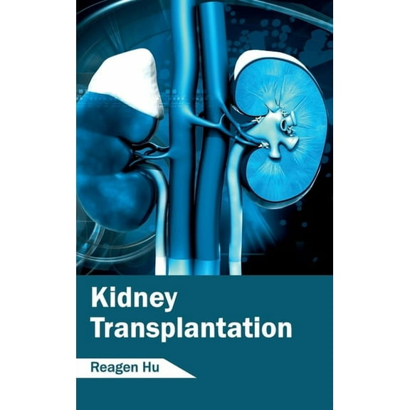 Kidney Transplantation, (Hardcover)