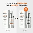 thumbnail image 3 of Super Vitamin C Serum for Women Over 70: Niacinamide, Vitamin C, Hyaluronic Acid, Peptides, Vitamin E, Caffeine, Bakuchiol, Hydrating, Lifting, Face Wrinkle & Age Spots Reduction, 3 of 9