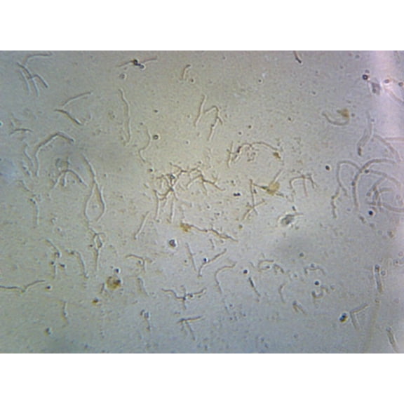 Leptospira (Spirochetes); Smear by Go Science Crazy