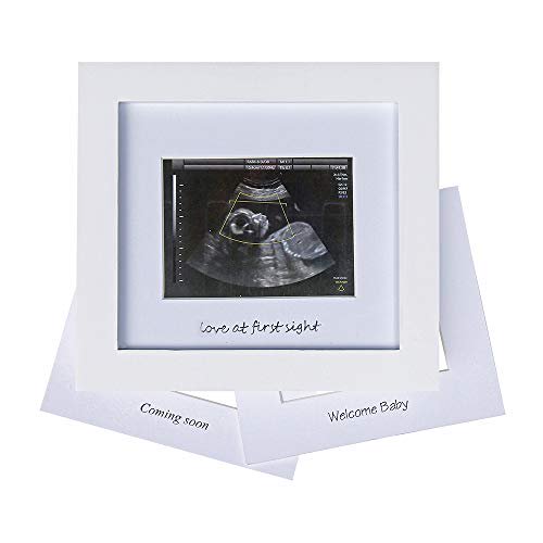 Sonogram Picture Frames