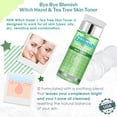 thumbnail image 4 of Tónico Bye Bye Blemish Witch Hazel + Árbol de Té 130 ml, 4 of 5