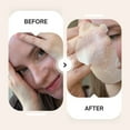 thumbnail image 2 of Maskeraide, Hydrocolloid Nose Patches, Nose strips, Pore strips, Spotted Pores, 2 of 5