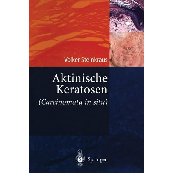 Aktinische Keratosen (Carcinomata in Situ), (Paperback)